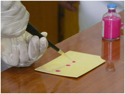 Test au rose Bengale