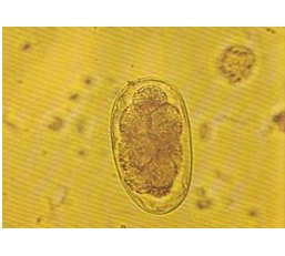 Un �uf d�<em>Haemonchus longistipes